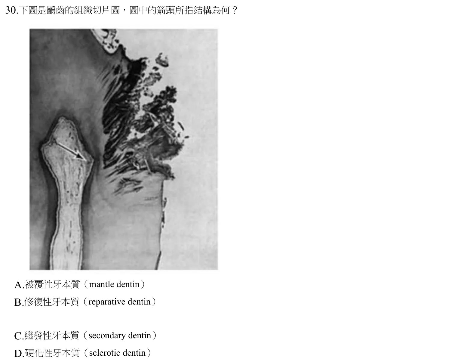 109 年第一次 牙醫學（三） 第 30 題附圖