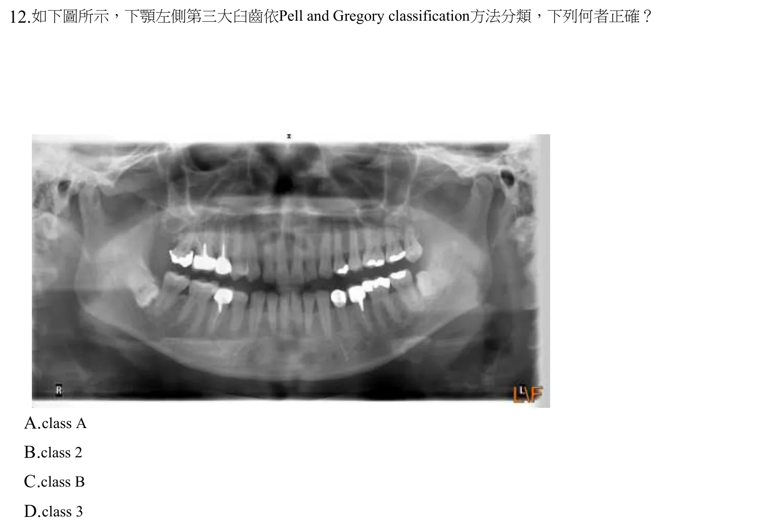 109 年第一次 牙醫學（四） 第 12 題附圖