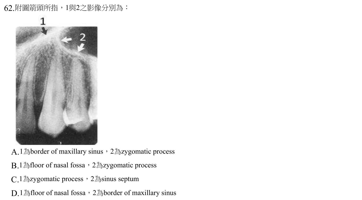 109 年第一次 牙醫學（四） 第 62 題附圖