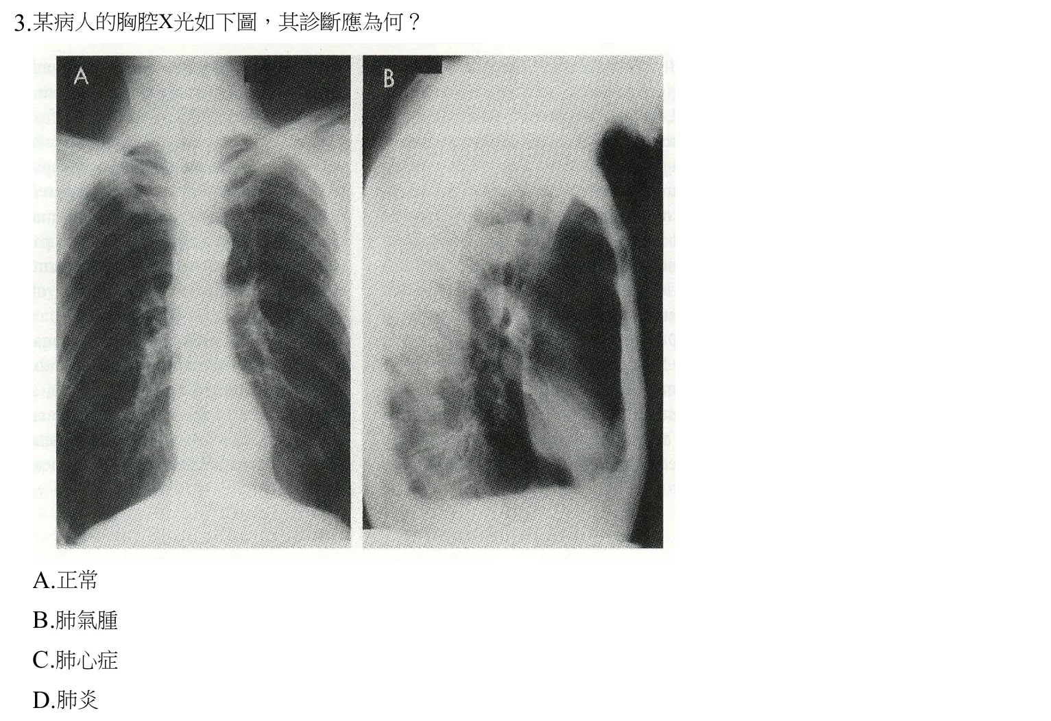 109 年第一次 心肺疾病與小兒疾病物理治療學 第 3 題附圖
