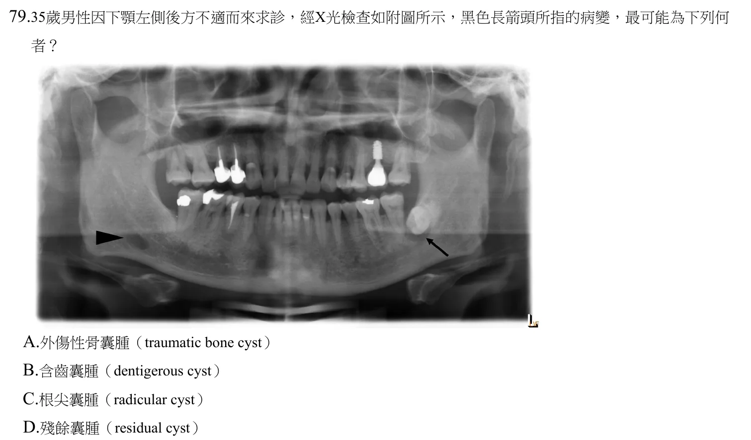 109 年第二次 牙醫學(四) 第 79 題附圖
