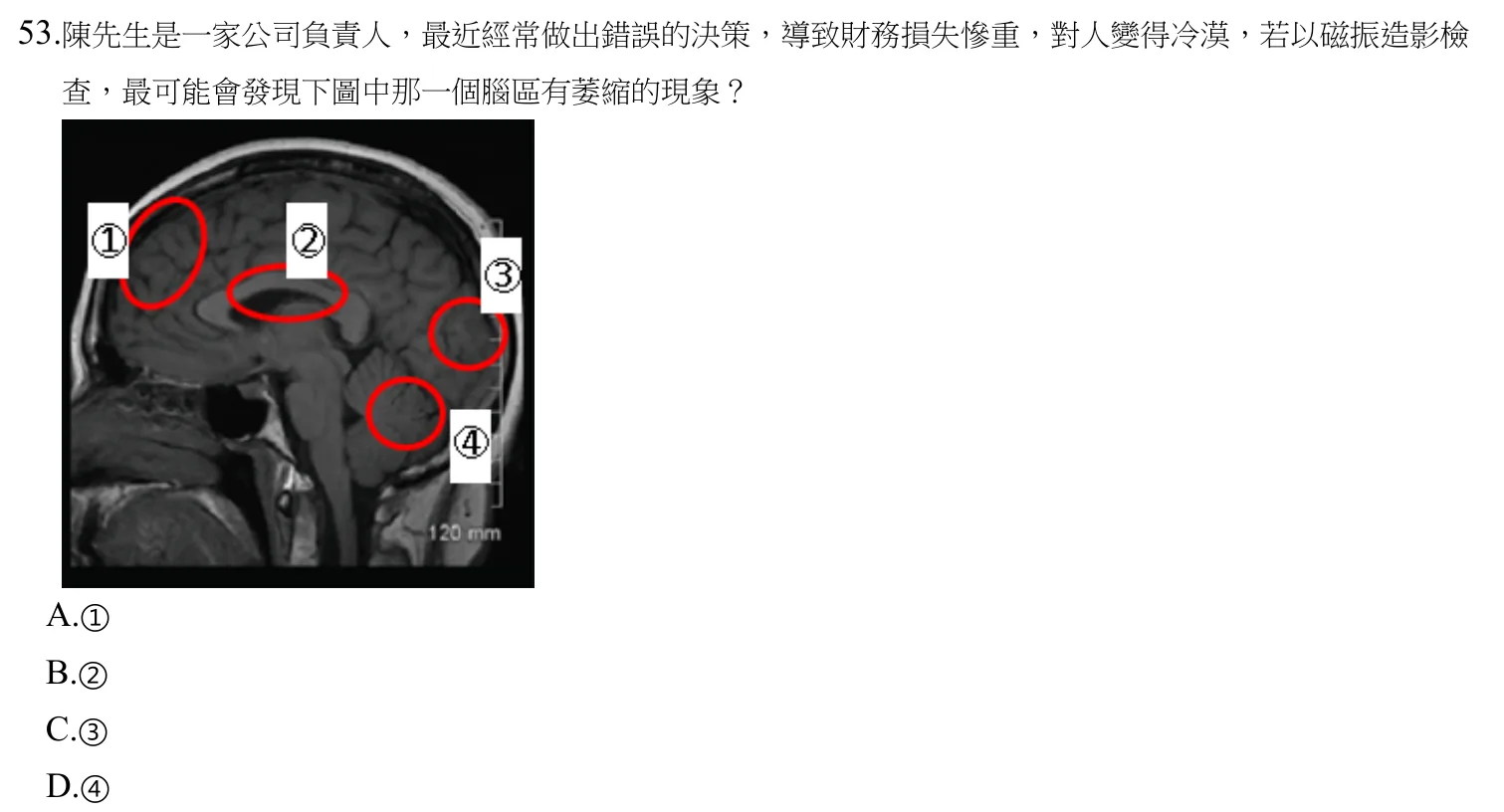 109 年第二次 神經疾病物理治療學 第 53 題附圖