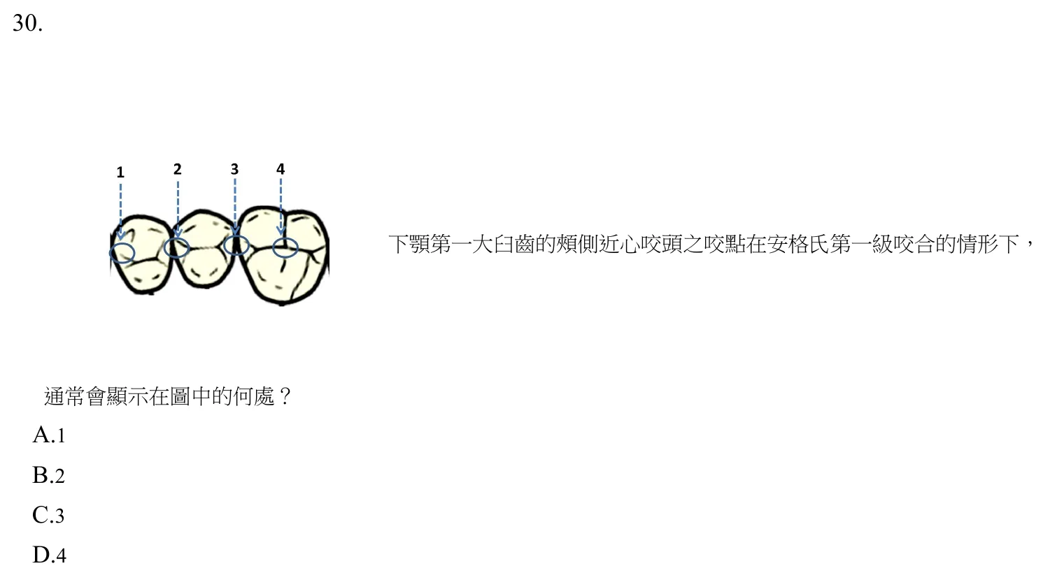 110 年第一次 牙醫學(一) 第 30 題附圖