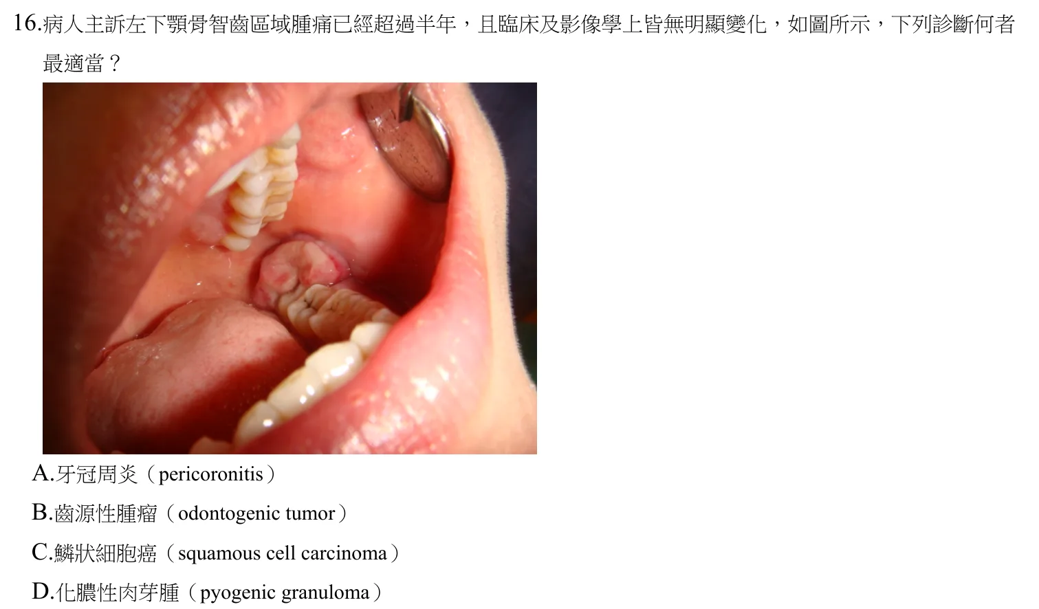 110 年第一次 牙醫學(四) 第 16 題附圖