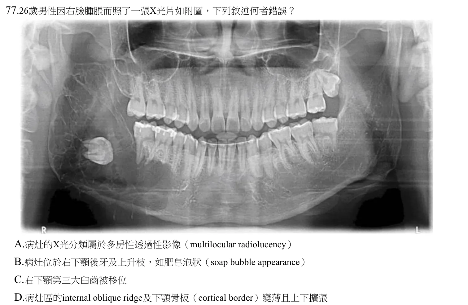 110 年第一次 牙醫學(四) 第 77 題附圖