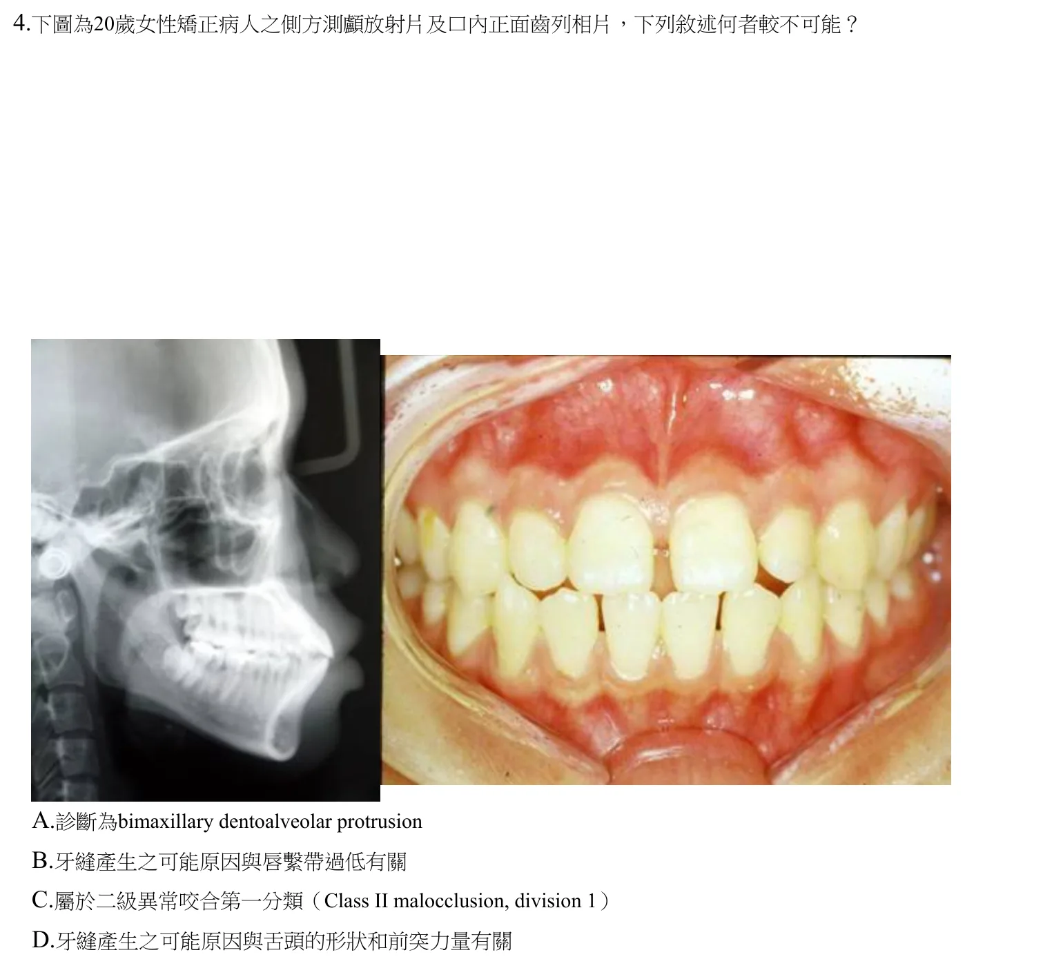 110 年第一次 牙醫學(六) 第 4 題附圖