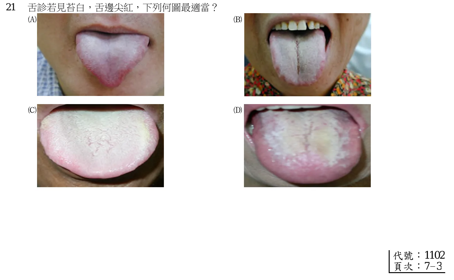 110 年第一次 中醫臨床醫學(一) 第 21 題附圖