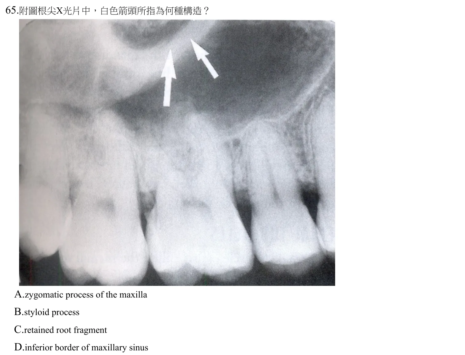 110 年第二次 牙醫學(四) 第 65 題附圖
