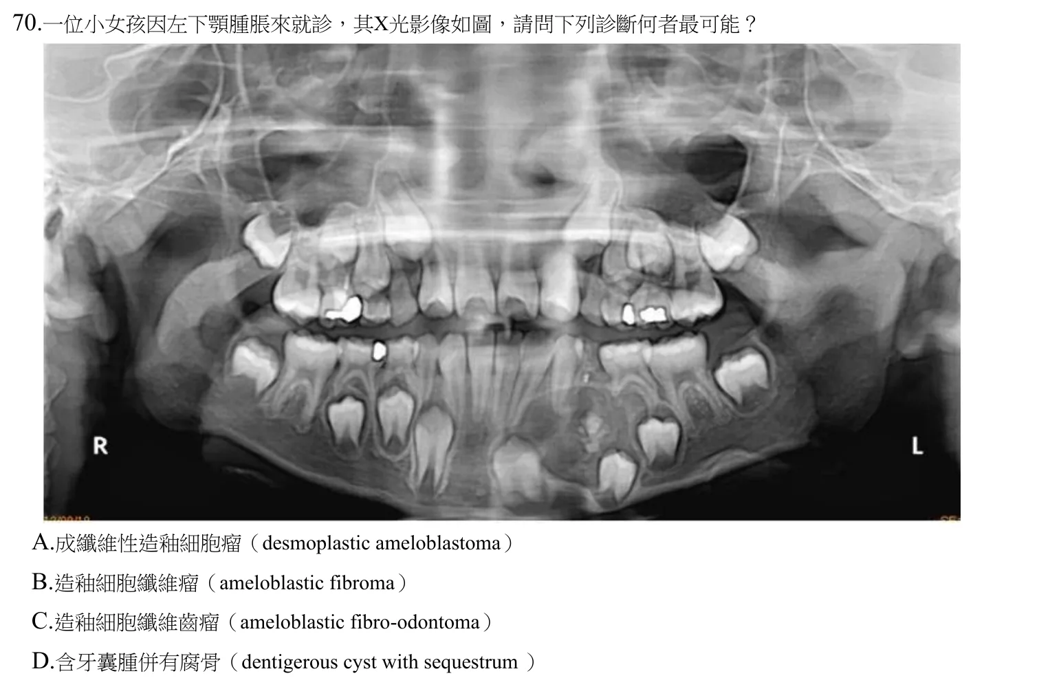 110 年第二次 牙醫學(四) 第 70 題附圖