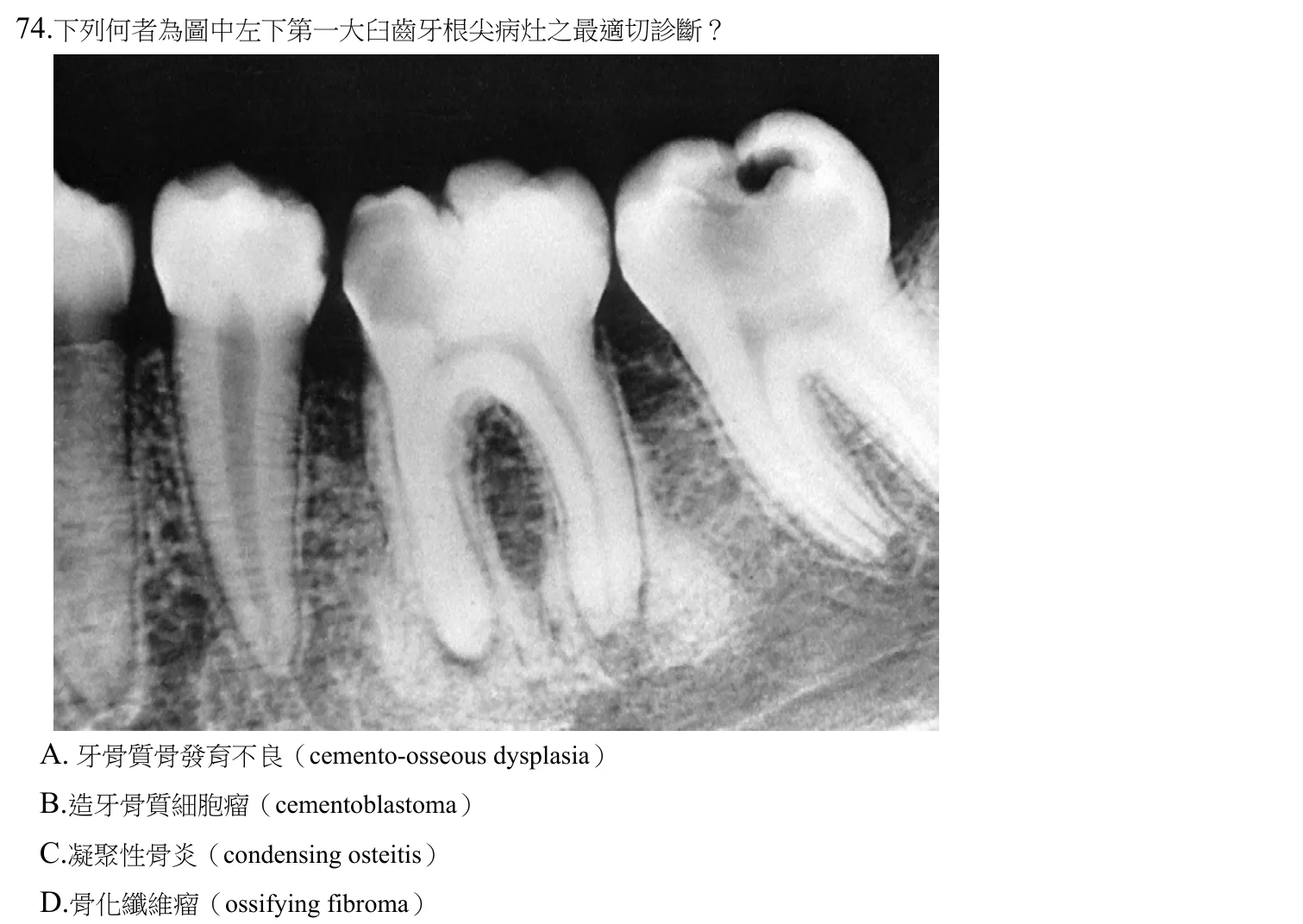 110 年第二次 牙醫學(四) 第 74 題附圖