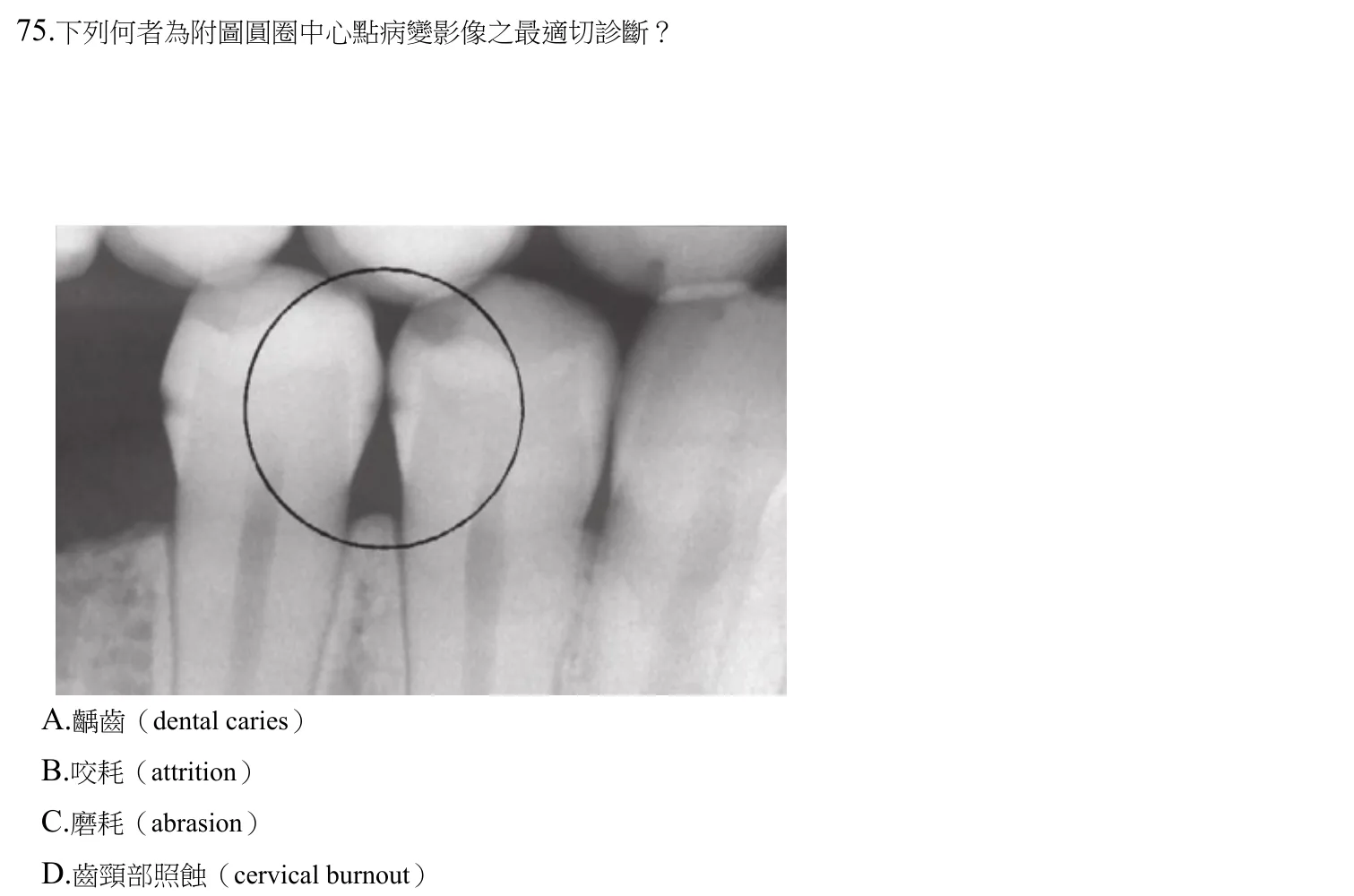 110 年第二次 牙醫學(四) 第 75 題附圖