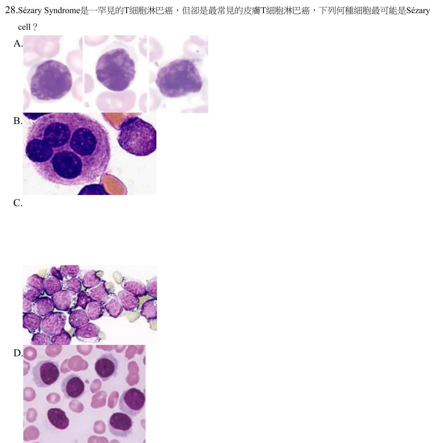 110 年第二次 臨床血液學與血庫學 第 28 題附圖