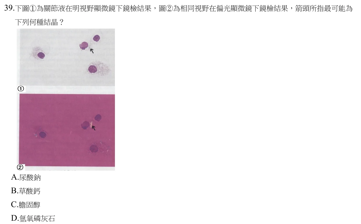 110 年第二次 醫學分子檢驗學與臨床鏡檢學 第 39 題附圖