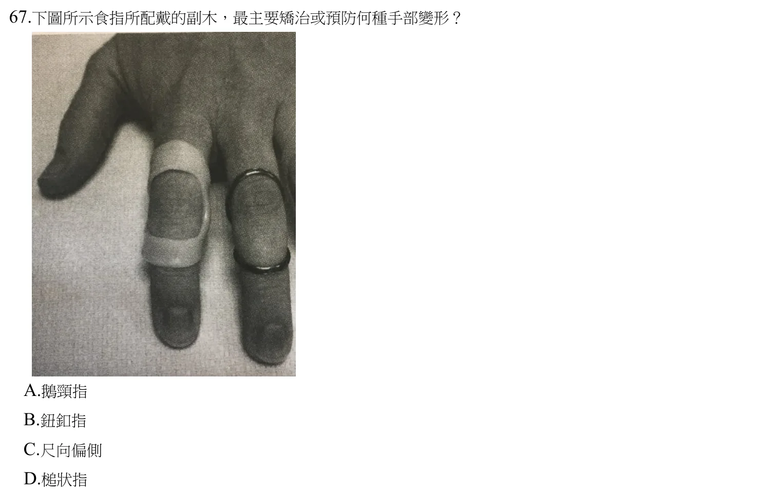 110 年第二次 生理障礙職能治療學 第 67 題附圖