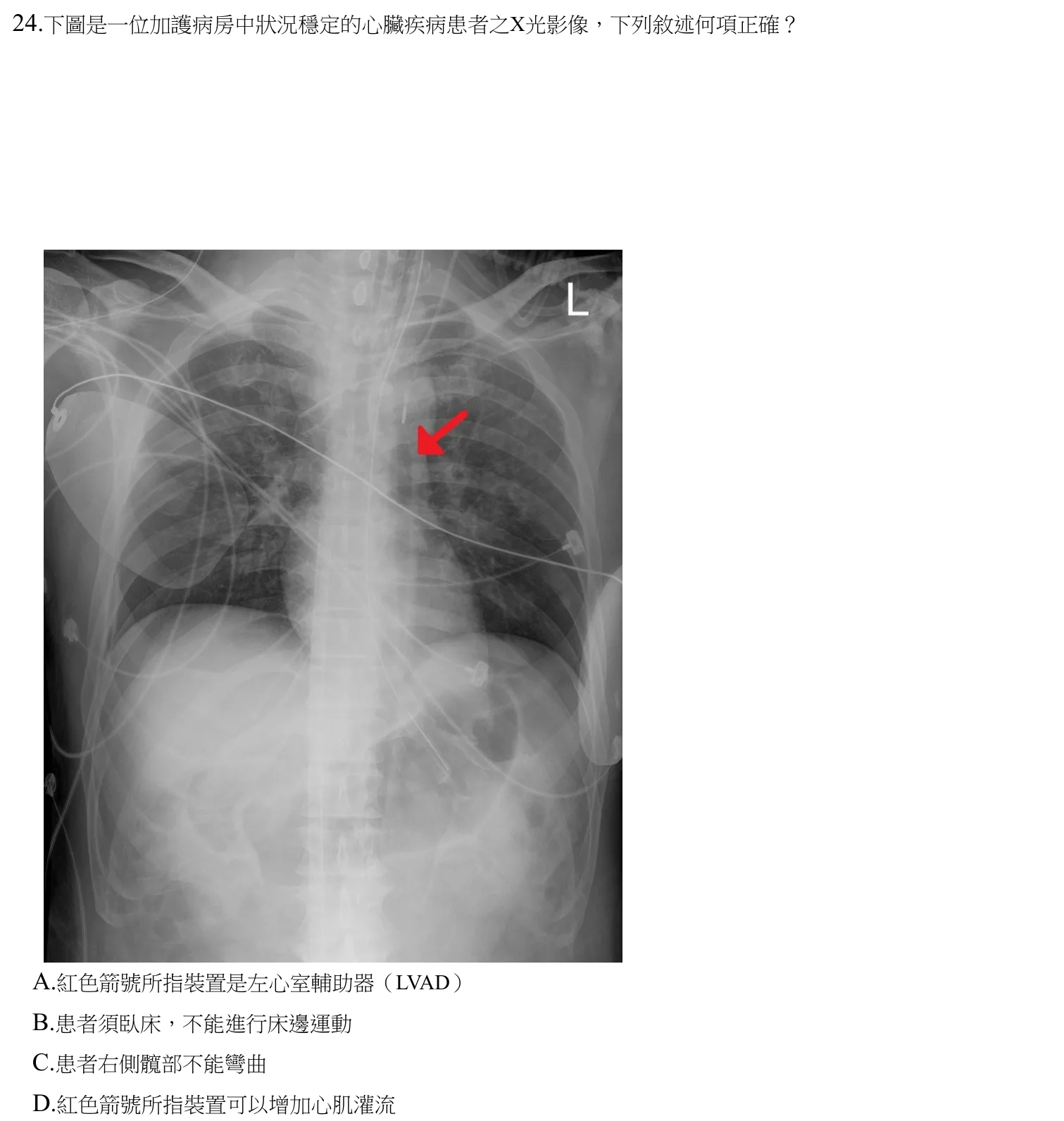 110 年第二次 心肺疾病與小兒疾病物理治療學 第 24 題附圖
