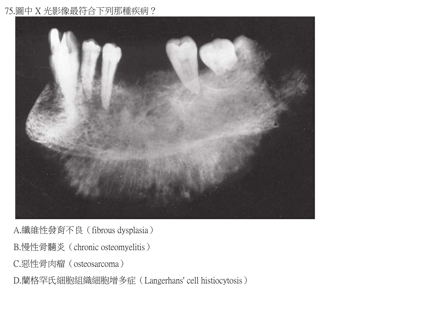 111 年第一次 牙醫學(四) 第 75 題附圖