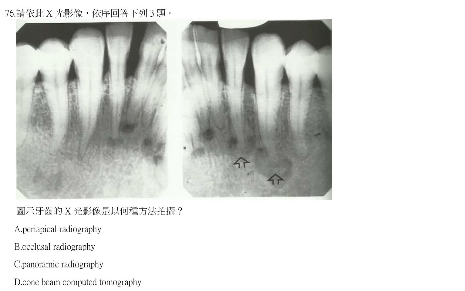 111 年第一次 牙醫學(四) 第 76 題附圖