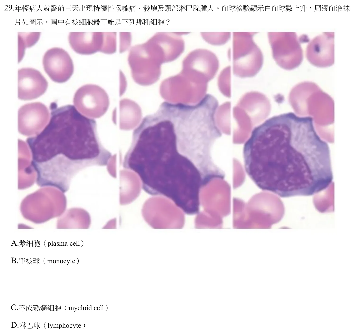 111 年第二次 臨床血液學與血庫學 第 29 題附圖