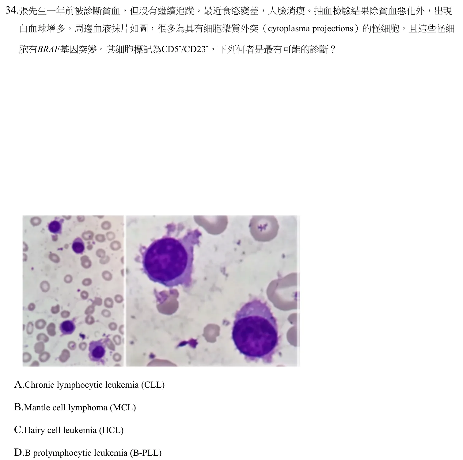 111 年第二次 臨床血液學與血庫學 第 34 題附圖