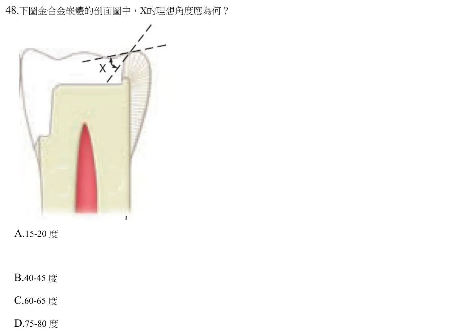112 年第一次 牙醫學(三) 第 48 題附圖