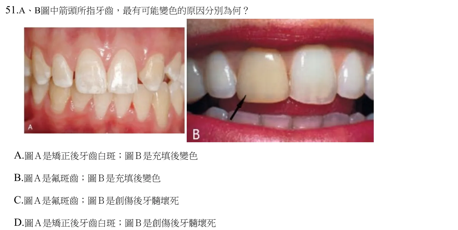 112 年第一次 牙醫學(三) 第 51 題附圖