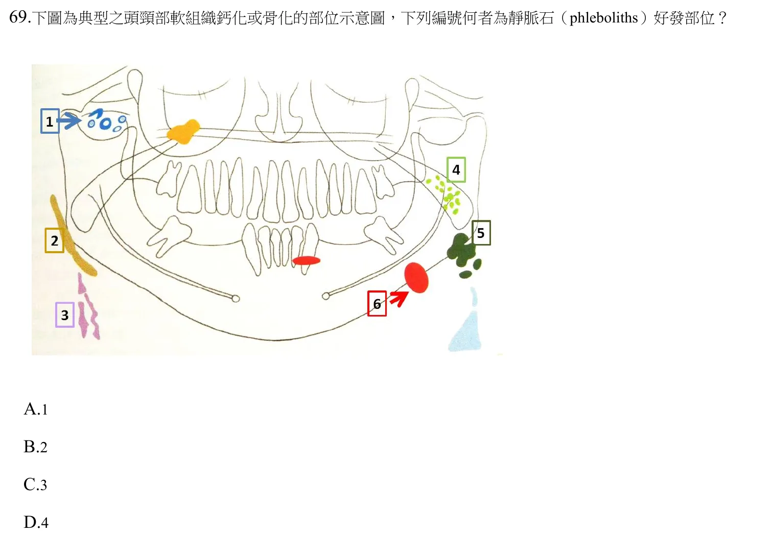 112 年第一次 牙醫學(四) 第 69 題附圖