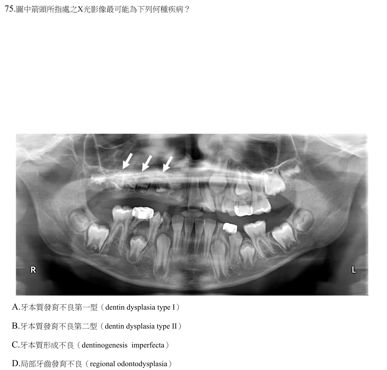 112 年第一次 牙醫學(四) 第 75 題附圖