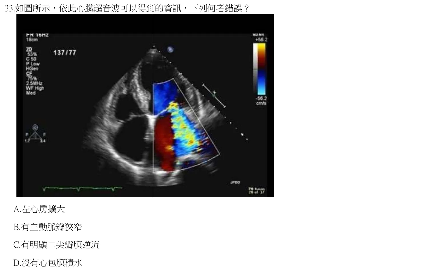 112 年第一次 臨床生理學與病理學 第 33 題附圖
