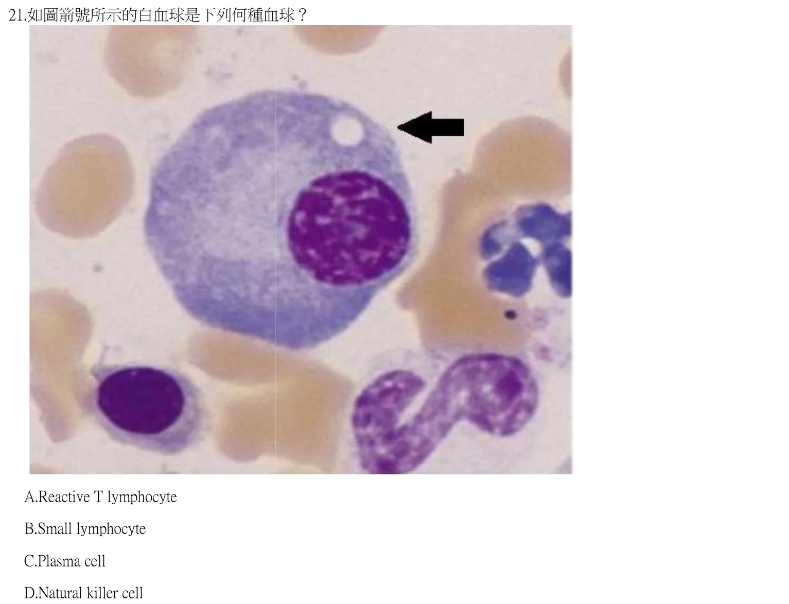 112 年第一次 臨床血液學與血庫學 第 21 題附圖