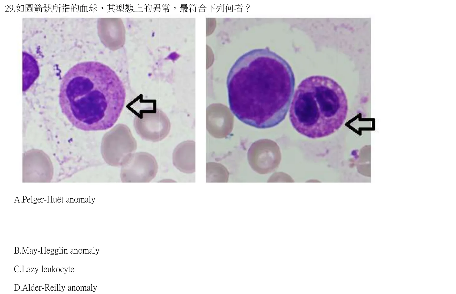 112 年第一次 臨床血液學與血庫學 第 29 題附圖
