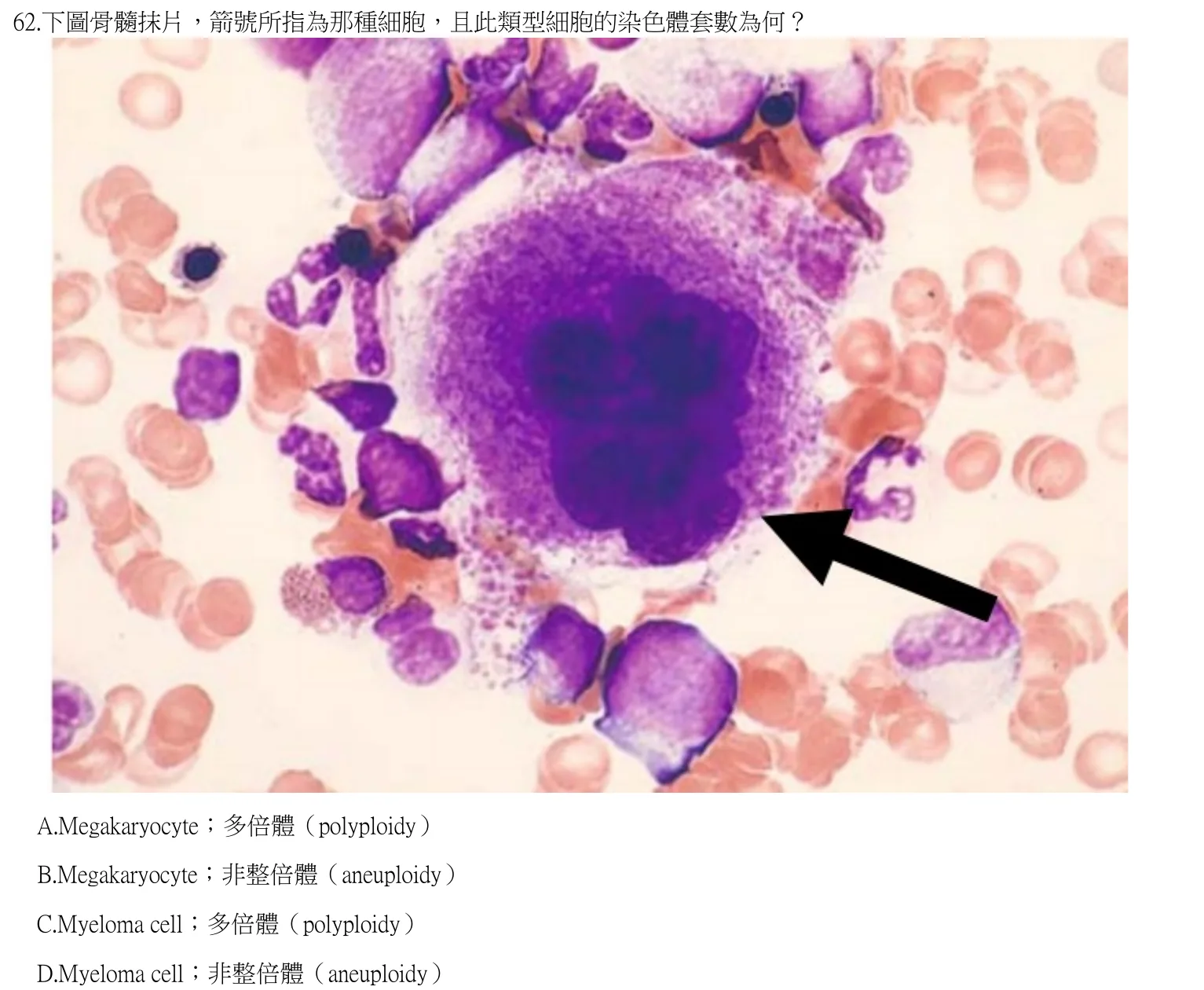 112 年第一次 臨床血液學與血庫學 第 62 題附圖