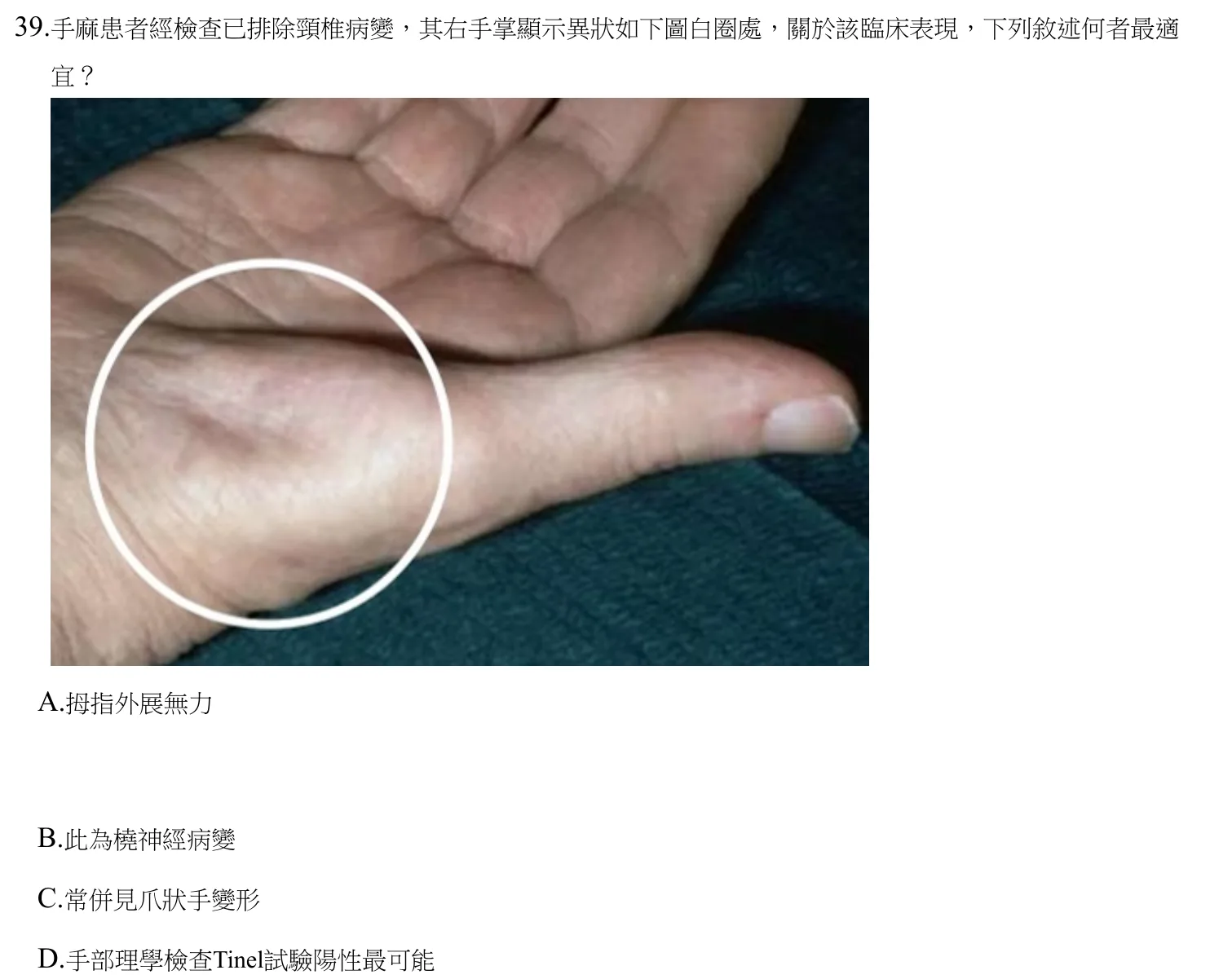 112 年第一次 中醫臨床醫學（三） 第 39 題附圖
