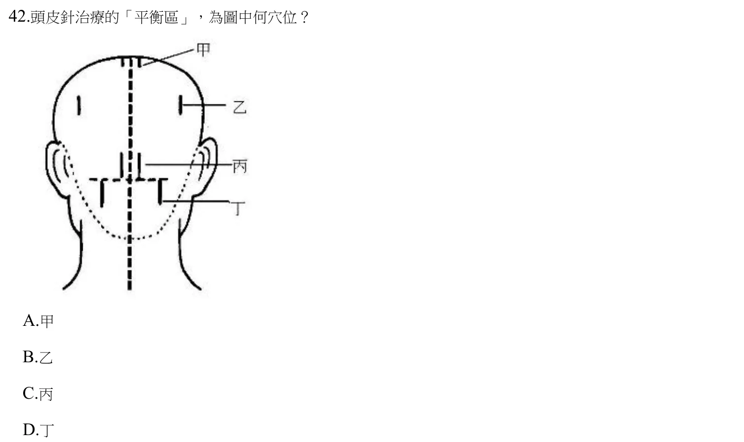 112 年第一次 中醫臨床醫學(四) 第 42 題附圖