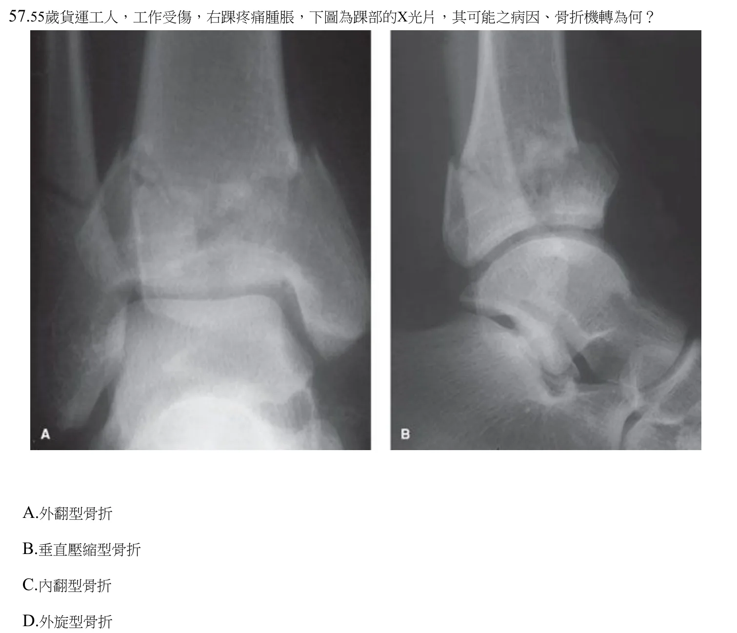 112 年第二次 中醫臨床醫學(三) 第 57 題附圖
