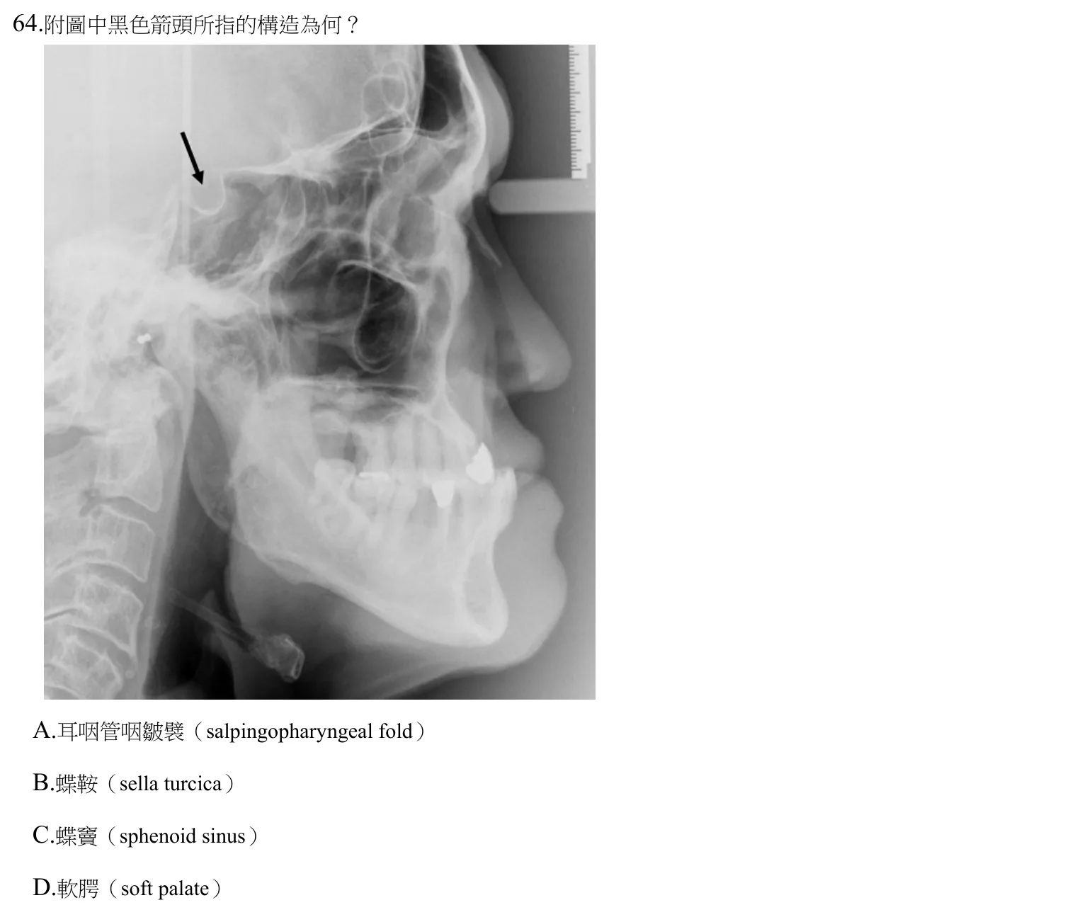 112 年第二次 牙醫學(四) 第 64 題附圖
