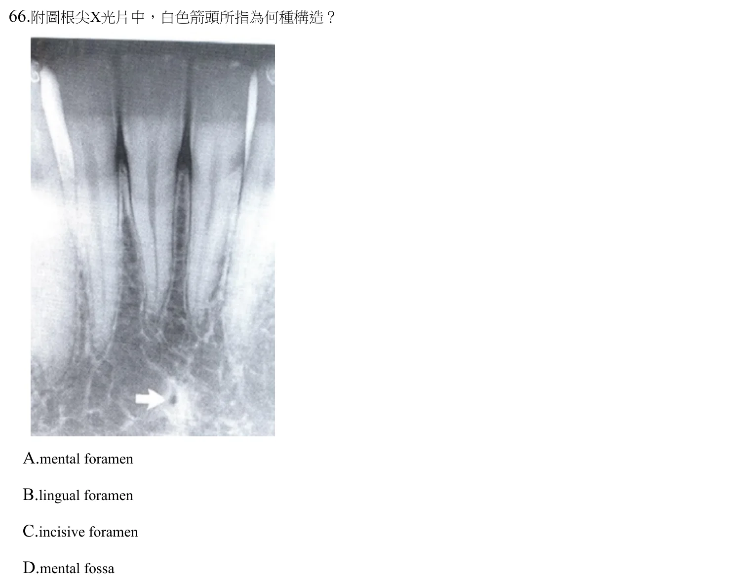 112 年第二次 牙醫學(四) 第 66 題附圖