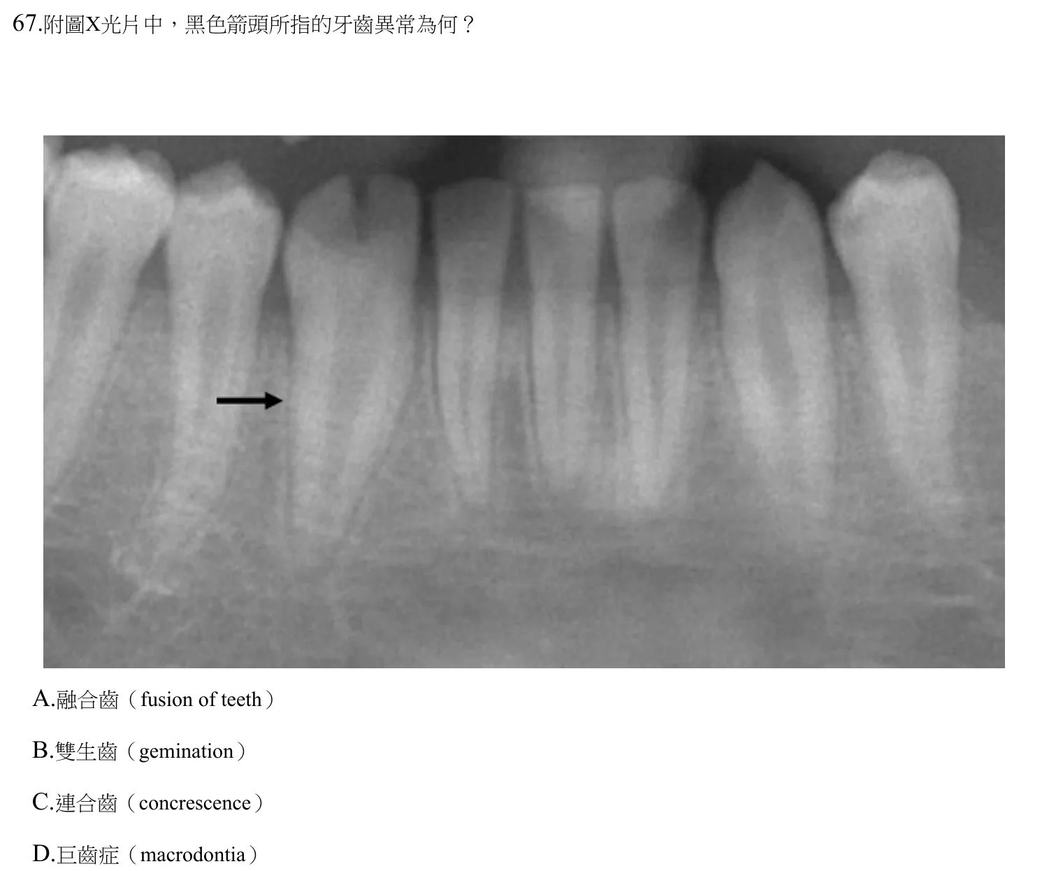 112 年第二次 牙醫學(四) 第 67 題附圖
