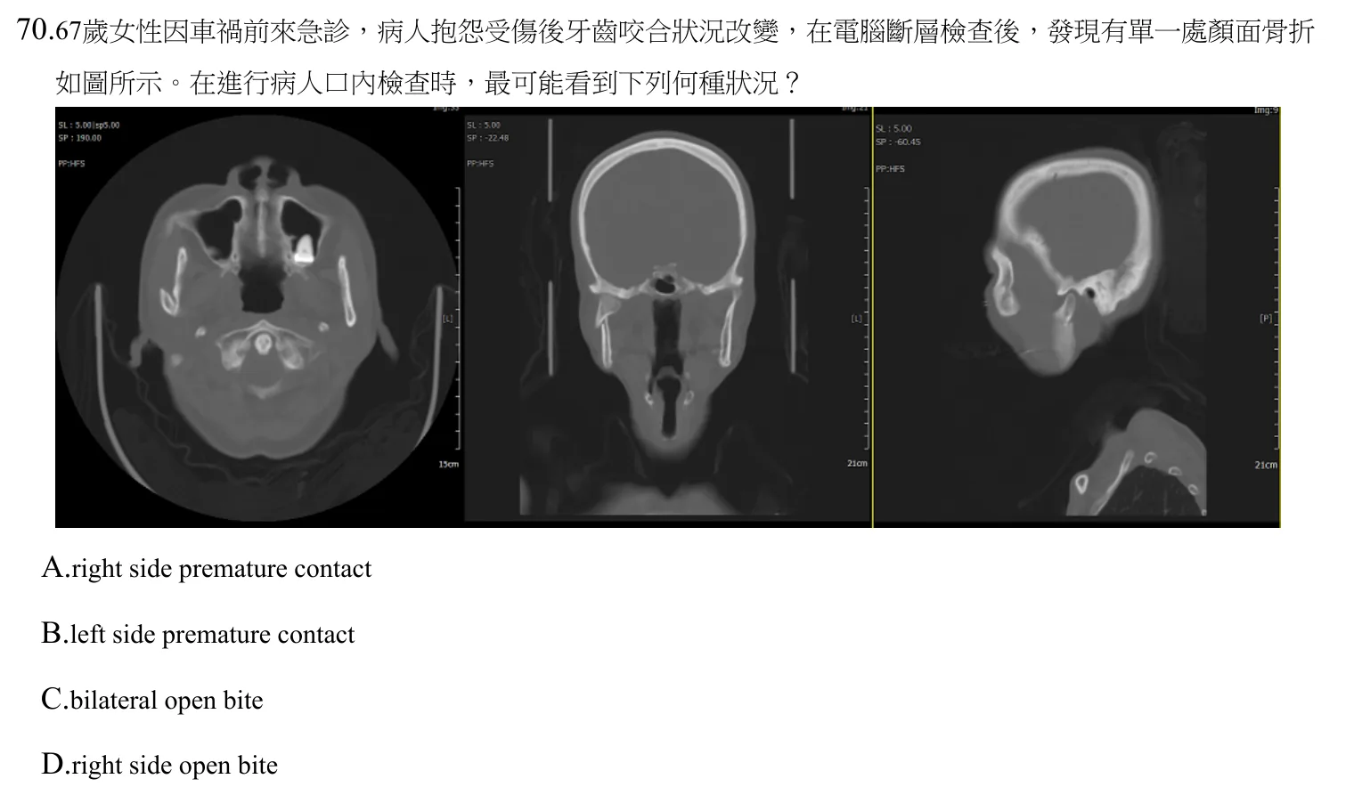 112 年第二次 牙醫學(四) 第 70 題附圖