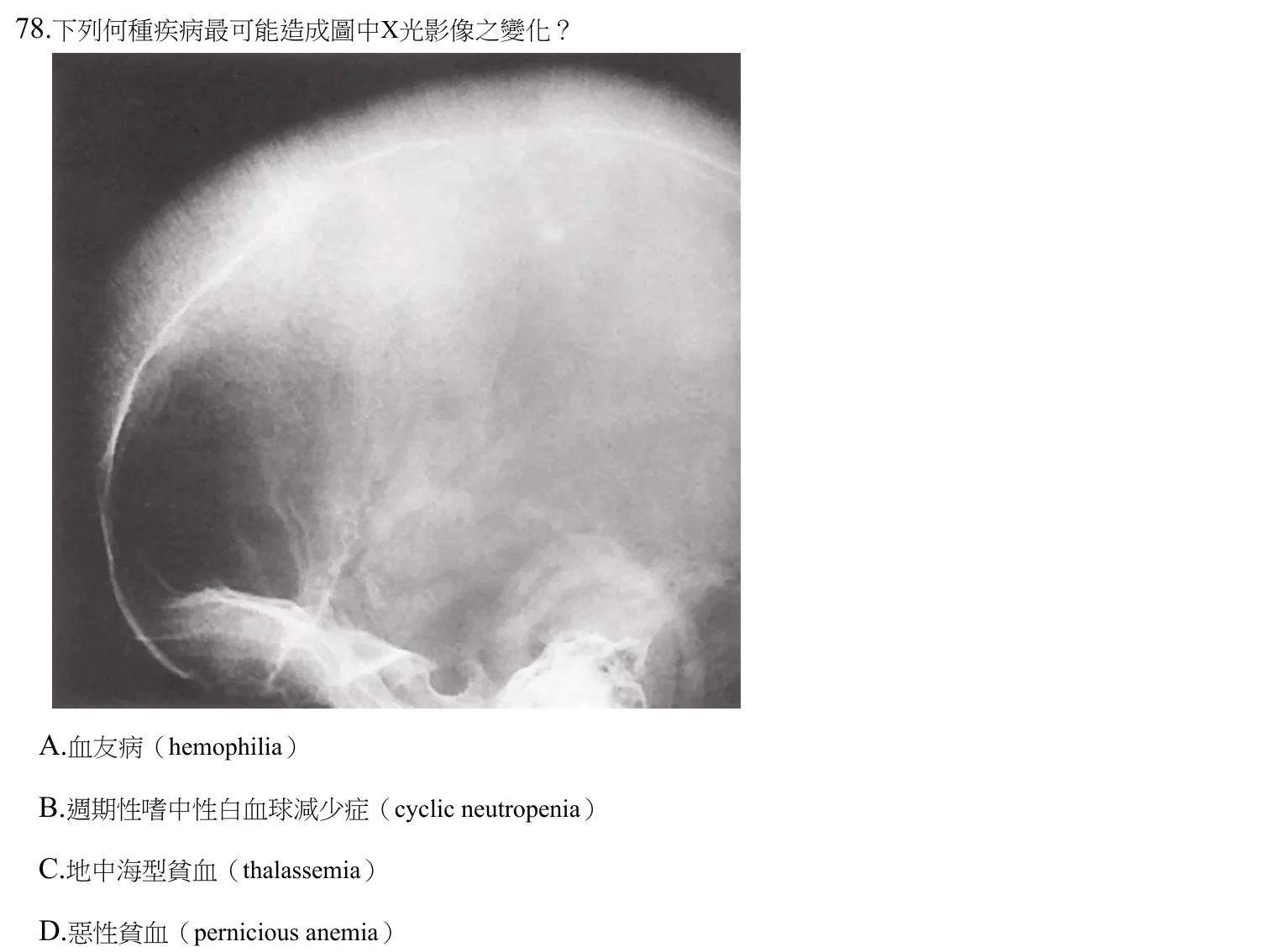 112 年第二次 牙醫學(四) 第 78 題附圖