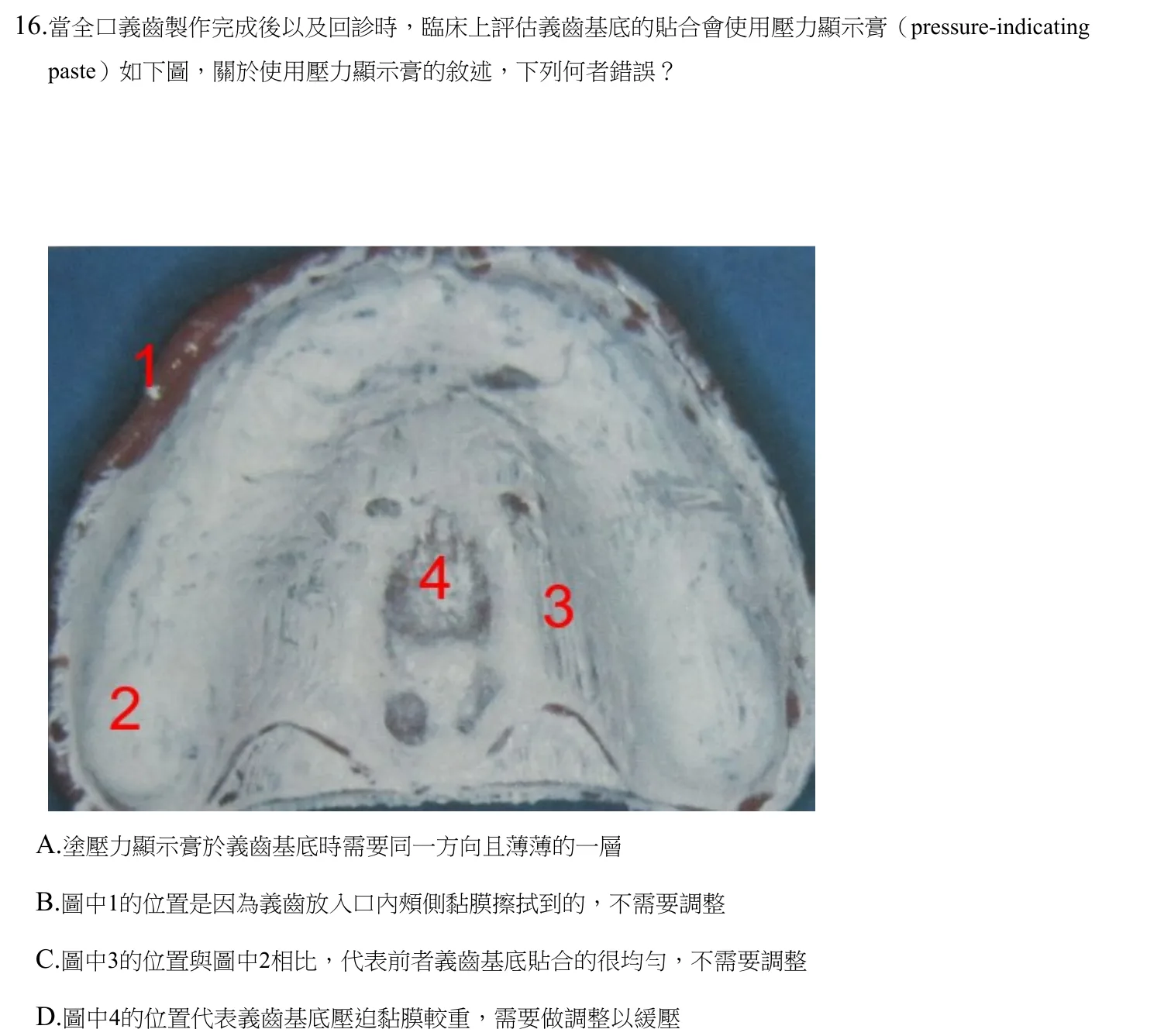 112 年第二次 牙醫學（五） 第 16 題附圖
