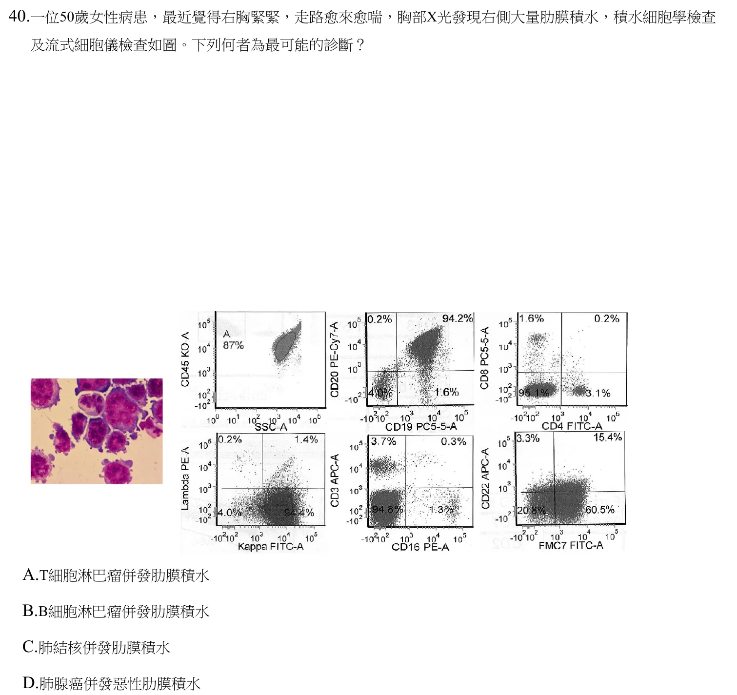 112 年第二次 臨床血液學與血庫學 第 40 題附圖