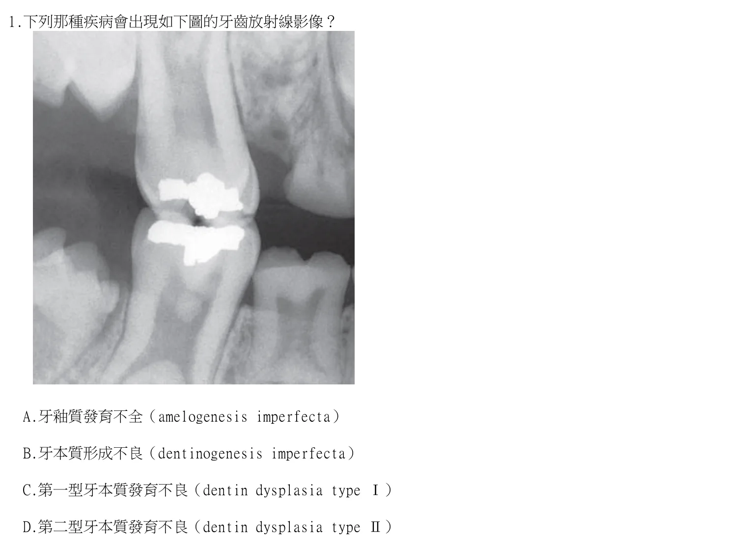 113 年第一次 牙醫學（二） 第 1 題附圖