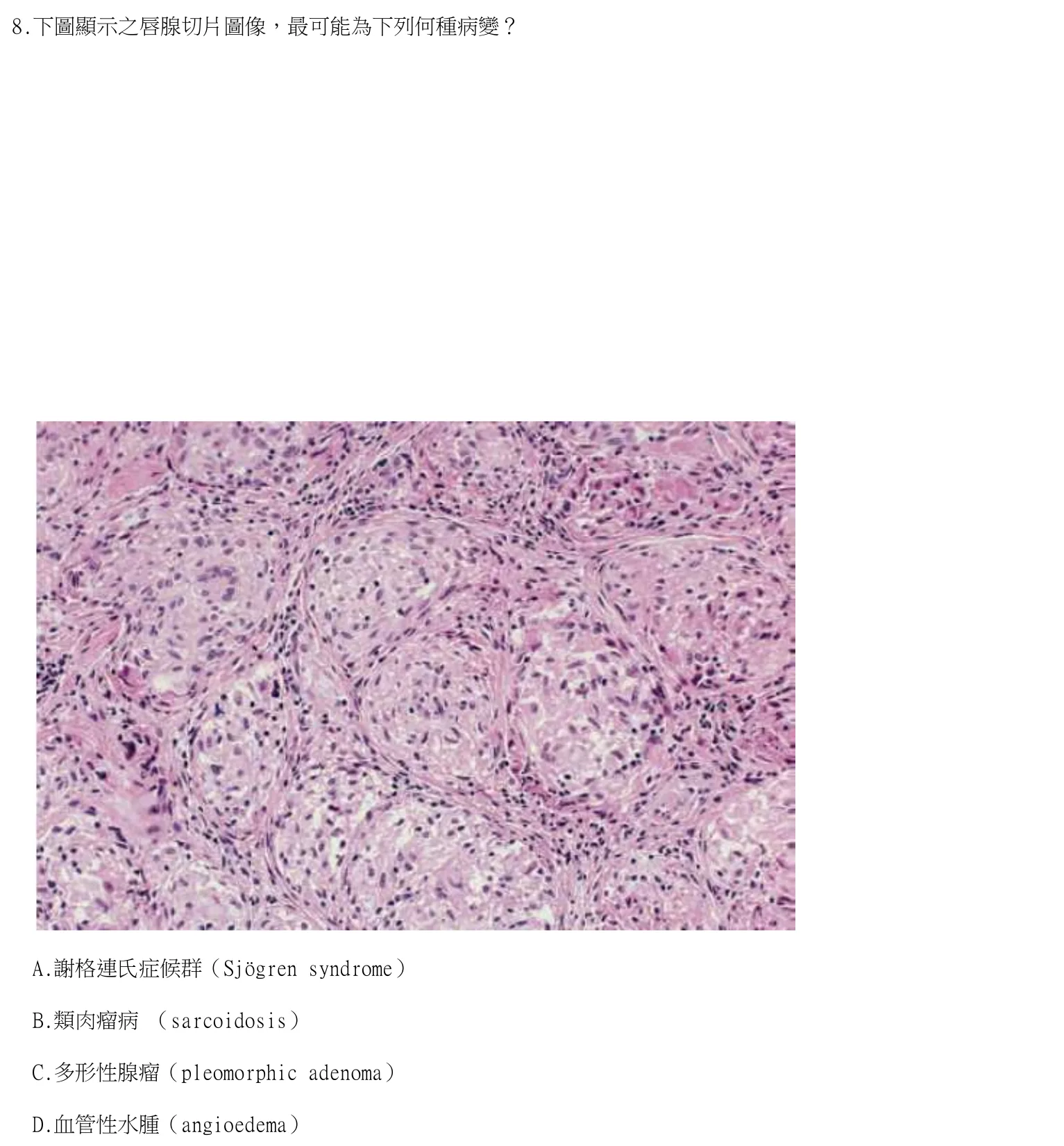 113 年第一次 牙醫學（二） 第 8 題附圖