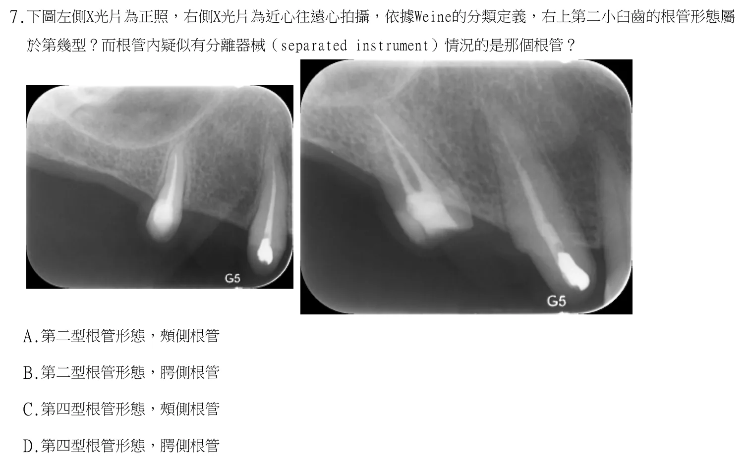 113 年第一次 牙醫學(三) 第 7 題附圖