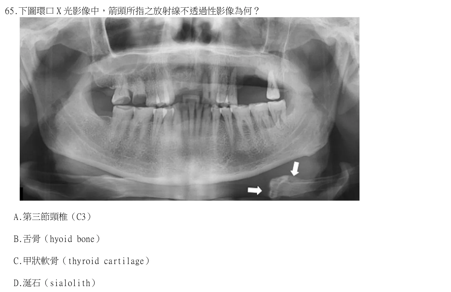 113 年第一次 牙醫學(四) 第 65 題附圖