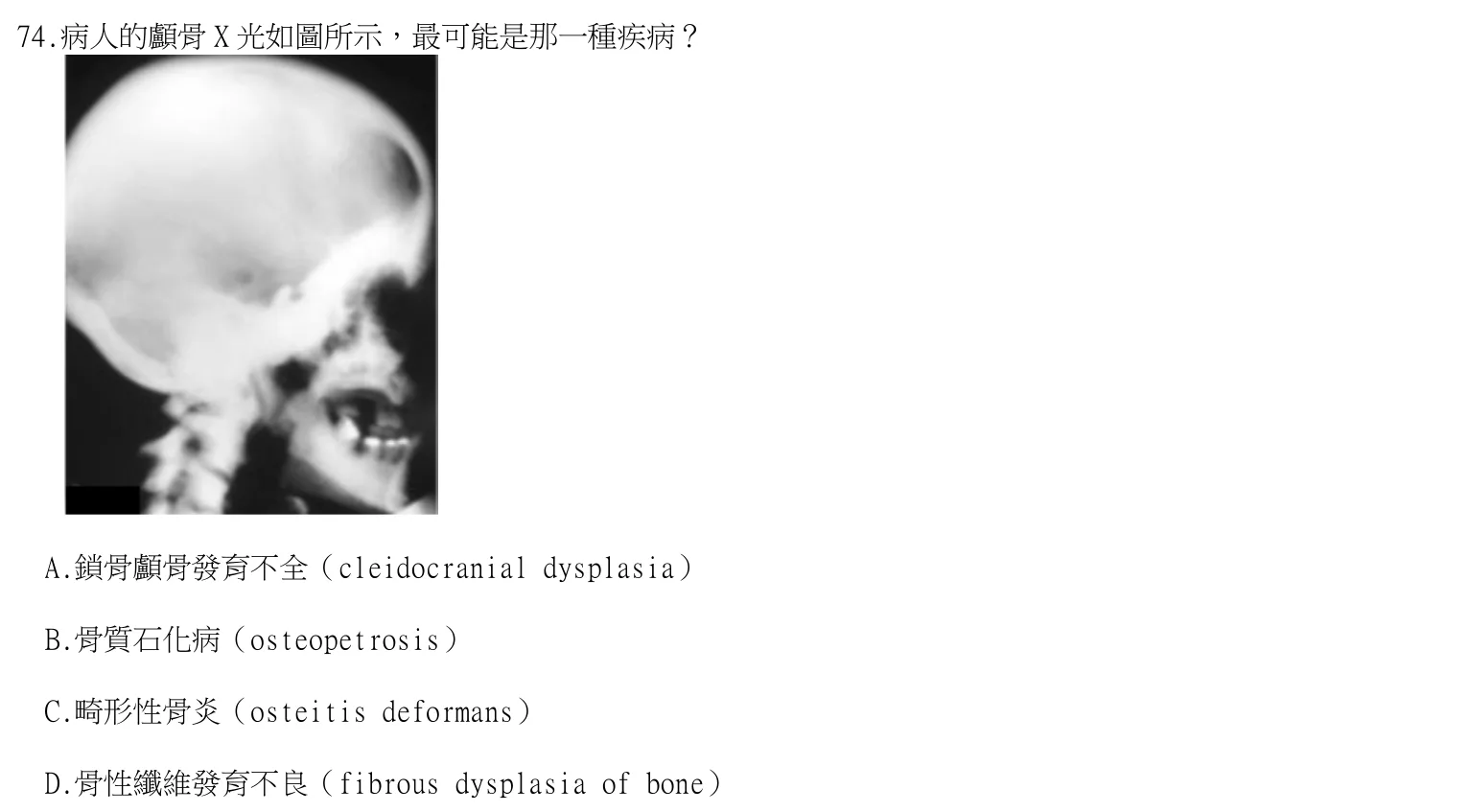 113 年第一次 牙醫學(四) 第 74 題附圖
