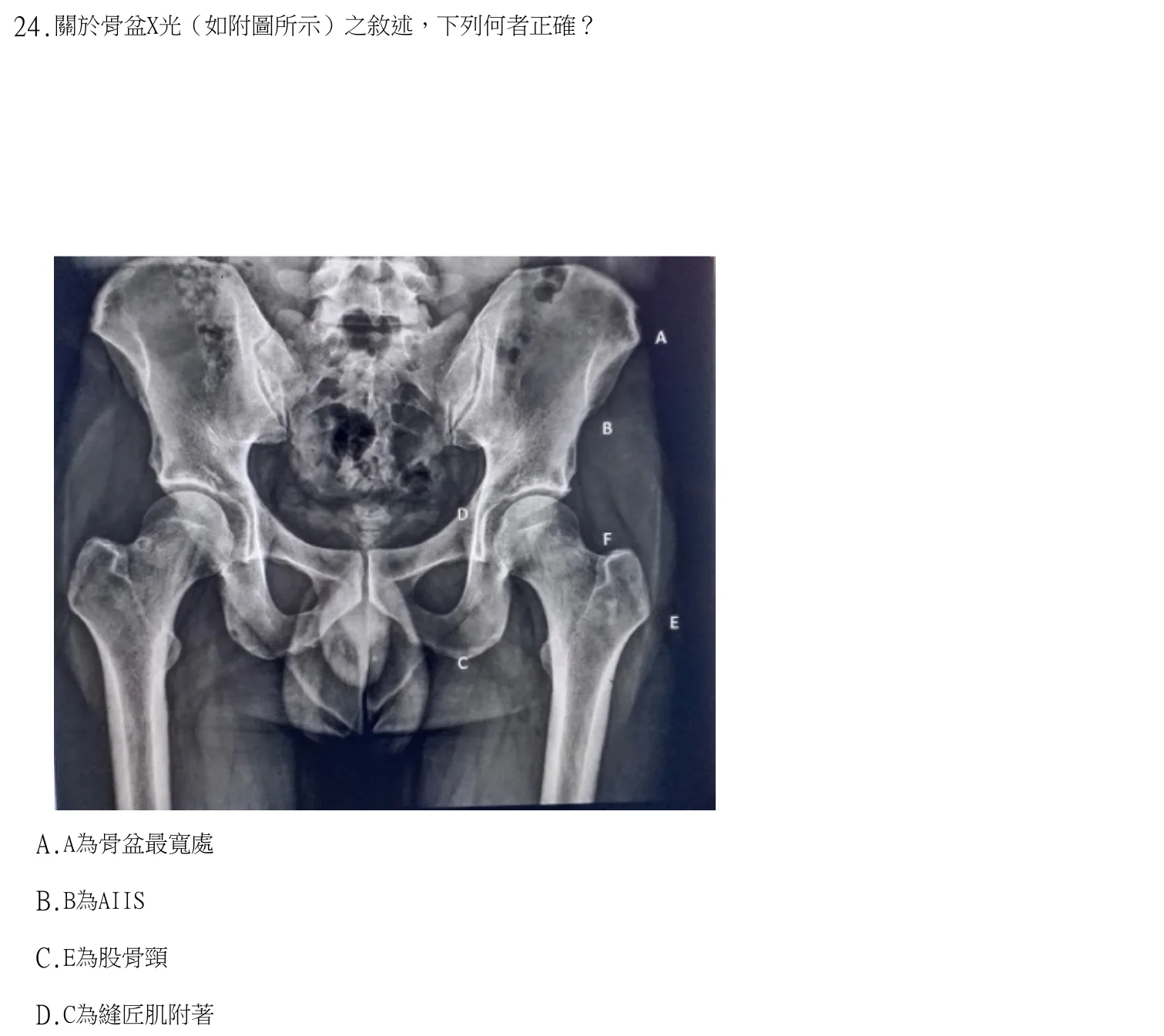 113 年第一次 中醫臨床醫學(三) 第 24 題附圖