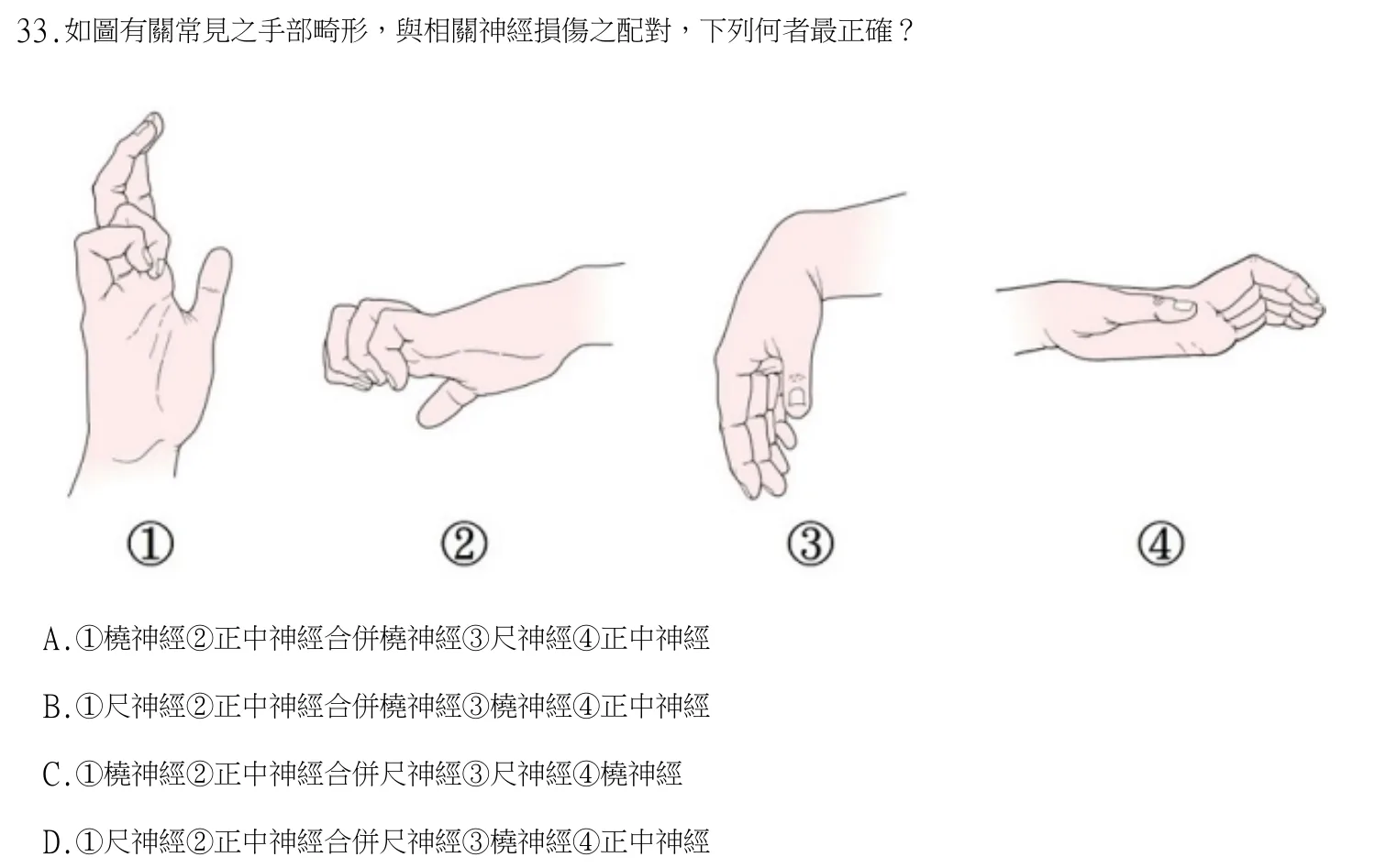 113 年第一次 中醫臨床醫學(三) 第 33 題附圖