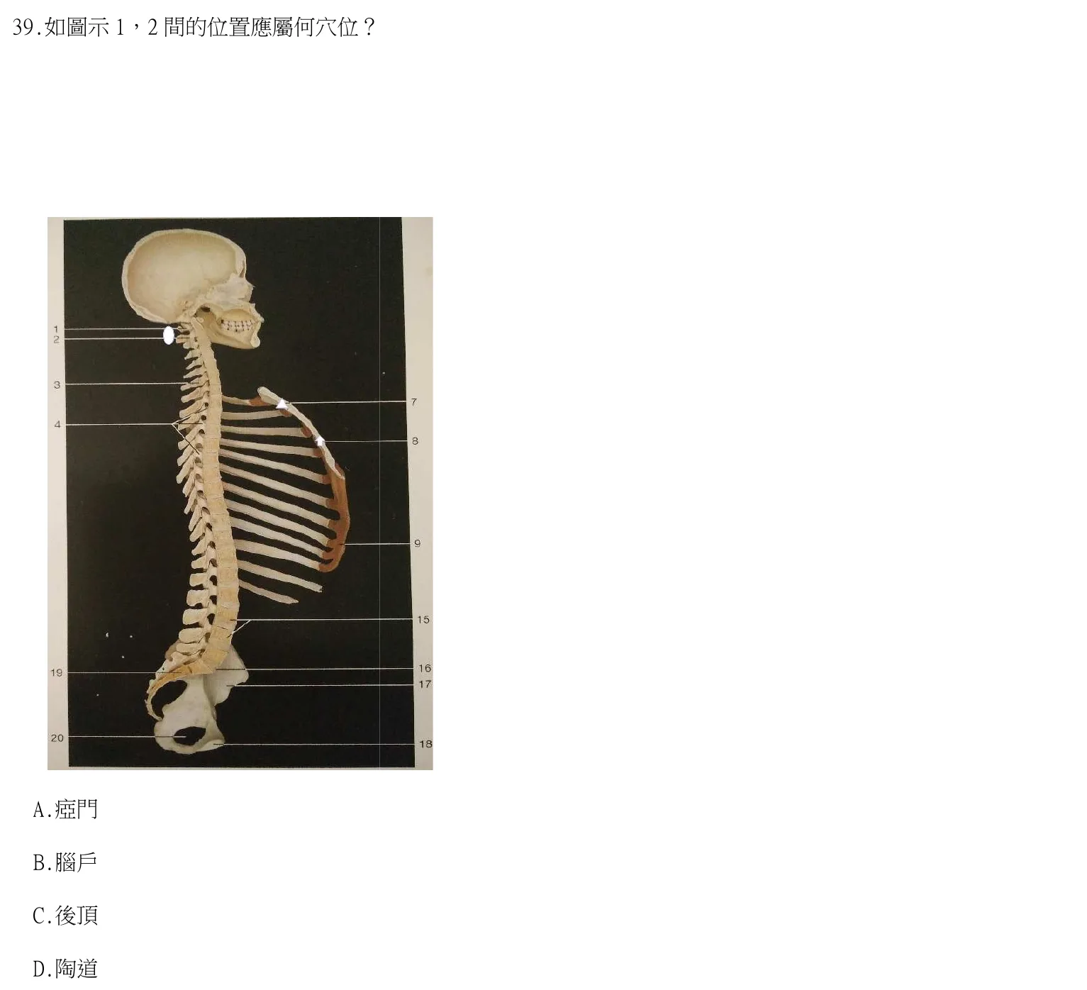 113 年第一次 中醫臨床醫學(四) 第 39 題附圖