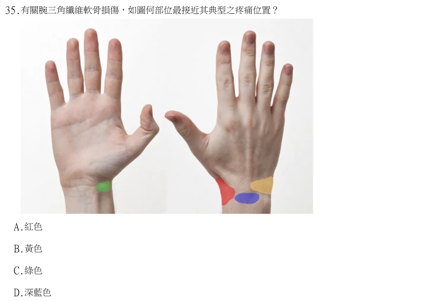 113 年第二次 中醫臨床醫學(三) 第 35 題附圖